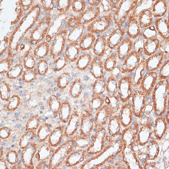 Immunohistochemistry of paraffin-embedded Mouse kidney using KIF4A Polyclonal Antibody at dilution of  1:100 (40x lens).