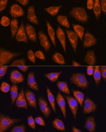 Immunofluorescence analysis of L929 cells using GOLGA4 Polyclonal Antibody at dilution of  1:100 (40x lens). Blue: DAPI for nuclear staining.