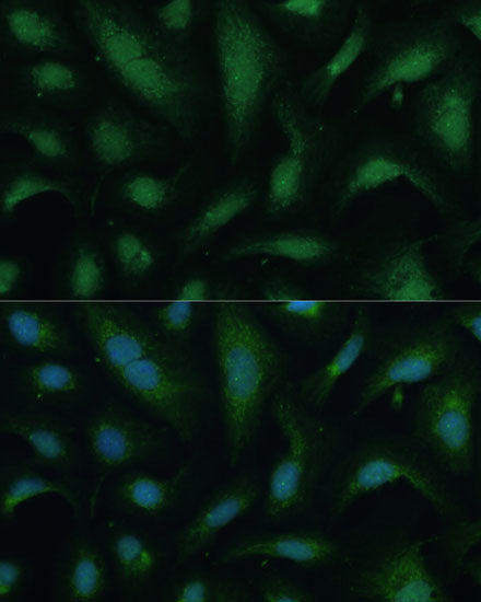 Immunofluorescence analysis of U-2 OS cells using KIF14 Polyclonal Antibody at dilution of  1:100 (40x lens). Blue: DAPI for nuclear staining.