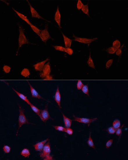 Immunofluorescence analysis of NIH-3T3 cells using DDAH1 Polyclonal Antibody at dilution of  1:100 (40x lens). Blue: DAPI for nuclear staining.