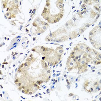 Immunohistochemistry of paraffin-embedded Human stomach using PCBP1 Polyclonal Antibody at dilution of  1:100 (40x lens).