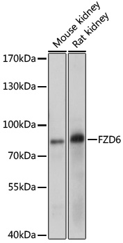 Western blot analysis of extracts of various cell line using FZD6 Polyclonal Antibody at dilution of 1:1000.