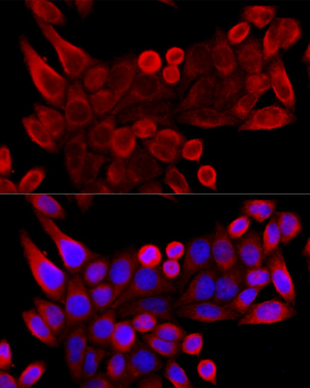Immunofluorescence analysis of HeLa cells using VDAC3 Polyclonal Antibody at dilution of  1:100 (40x lens). Blue: DAPI for nuclear staining.