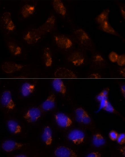 Immunofluorescence analysis of U-2 OS cells using SEC14L2 Polyclonal Antibody at dilution of  1:100 (40x lens). Blue: DAPI for nuclear staining.