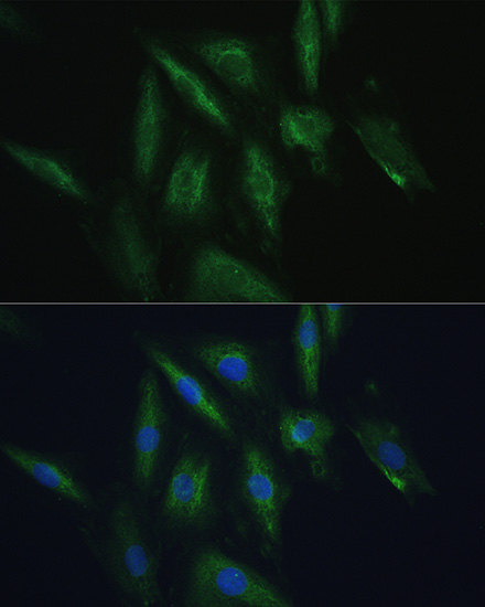 Immunofluorescence analysis of H9C2 cells using SRPRB Polyclonal Antibody at dilution of  1:100. Blue: DAPI for nuclear staining.