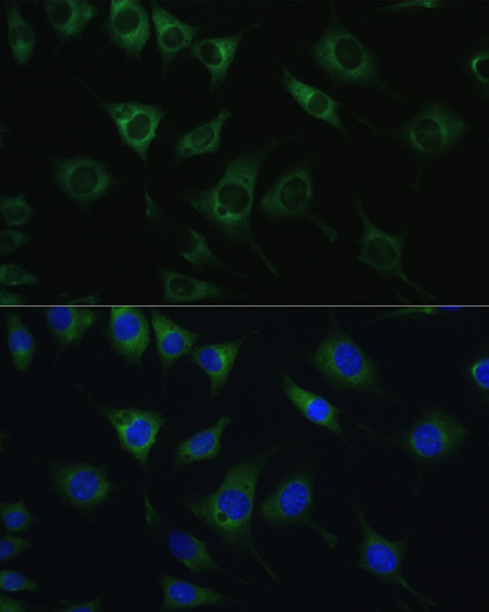 Immunofluorescence analysis of L929 cells using SRPRB Polyclonal Antibody at dilution of  1:100. Blue: DAPI for nuclear staining.