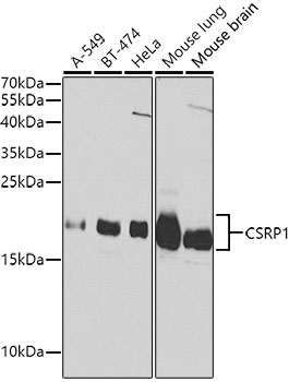 Western blot analysis of extracts of various cell lines using CSRP1 Polyclonal Antibody at dilution of 1:1000.