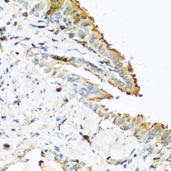 Immunohistochemistry of paraffin-embedded Mouse lung using RNASE13 Polyclonal Antibody at dilution of  1:100 (40x lens).