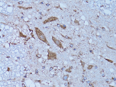 Immunohistochemistry of paraffin-embedded Rat spinal cord using HADH Polyclonal Antibody at dilution of  1:100 (40x lens).