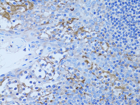 Immunohistochemistry of paraffin-embedded Human tonsil using HADH Polyclonal Antibody at dilution of  1:100 (40x lens).