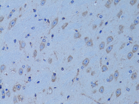 Immunohistochemistry of paraffin-embedded Mouse brain using HADH Polyclonal Antibody at dilution of  1:100 (40x lens).