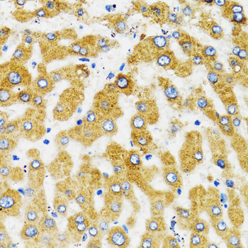 Immunohistochemistry of paraffin-embedded Human liver using SLC27A2 Polyclonal Antibody at dilution of  1:100 (40x lens).