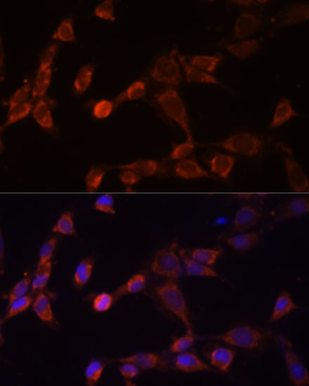 Immunofluorescence analysis of NIH-3T3 cells using PSMD14 Polyclonal Antibody at dilution of  1:100 (40x lens). Blue: DAPI for nuclear staining.