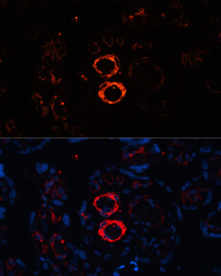 Immunofluorescence analysis of Human placenta cells using MYH11 Polyclonal Antibody at dilution of  1:100. Blue: DAPI for nuclear staining.