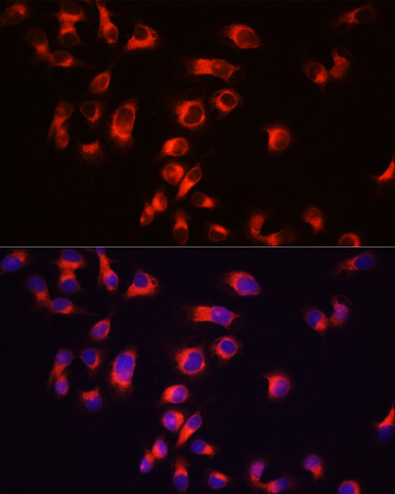 Immunofluorescence analysis of A431 cells using Tau Polyclonal Antibody at dilution of  1:100 (40x lens). Blue: DAPI for nuclear staining.