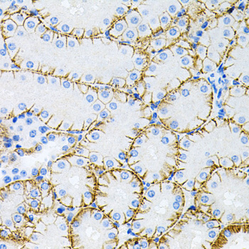 Immunohistochemistry of paraffin-embedded Mouse kidney using Tau Polyclonal Antibody at dilution of  1:100 (40x lens).