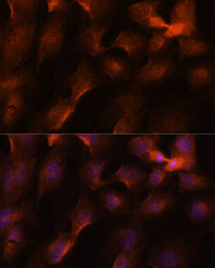 Immunofluorescence analysis of C6 cells using BRCA1 Polyclonal Antibody at dilution of  1:100. Blue: DAPI for nuclear staining.