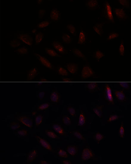 Immunofluorescence analysis of U-2 OS cells using BRCA1 Polyclonal Antibody at dilution of  1:100. Blue: DAPI for nuclear staining.