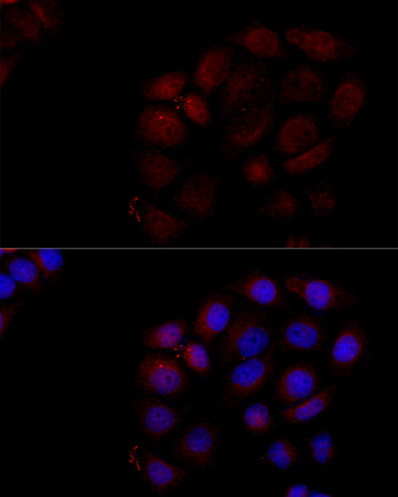 Immunofluorescence analysis of HeLa cells using Caspase-3 Polyclonal Antibody at dilution of  1:100 (40x lens). Blue: DAPI for nuclear staining.