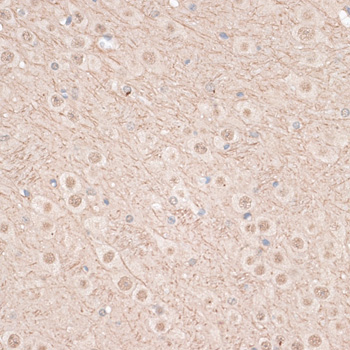 Immunohistochemistry of paraffin-embedded Mouse brain using VEGF Receptor 2 Polyclonal Antibody at dilution of  1:100 (40x lens).