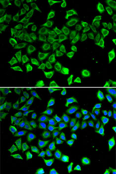 Immunofluorescence analysis of A-549 cells using LCN2 Polyclonal Antibody