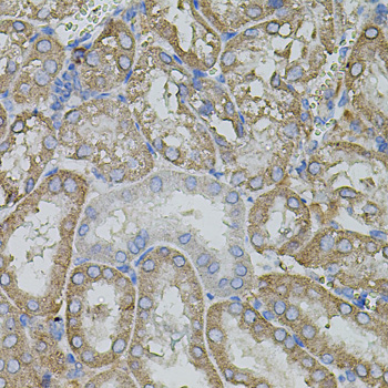 Immunohistochemistry of paraffin-embedded Mouse kidney using MMP9 Polyclonal Antibody at dilution of  1:100 (40x lens).