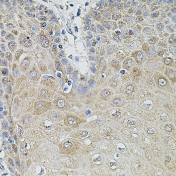 Immunohistochemistry of paraffin-embedded Human esophagus using MMP9 Polyclonal Antibody at dilution of  1:100 (40x lens).