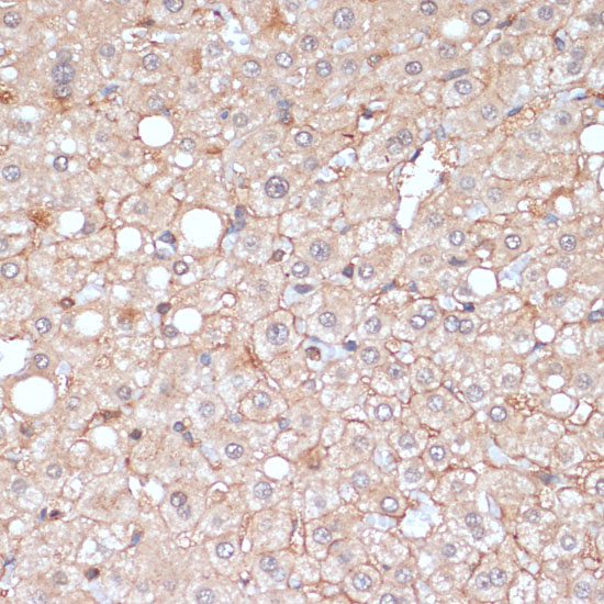 Immunohistochemistry of paraffin-embedded Human liver using MMP9 Polyclonal Antibody at dilution of  1:100 (40x lens).