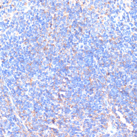 Immunohistochemistry of paraffin-embedded Mouse spleen using MMP9 Polyclonal Antibody at dilution of  1:100 (40x lens).