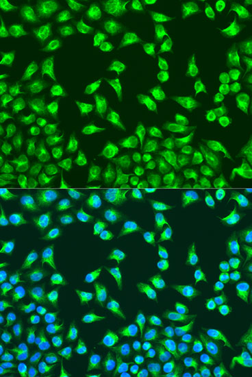 Immunofluorescence analysis of U2OS cells using MTCO2 Polyclonal Antibody at dilution of  1:100. Blue: DAPI for nuclear staining.