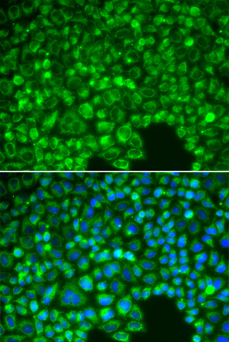 Immunofluorescence analysis of HeLa cells using IKB alpha Polyclonal Antibody