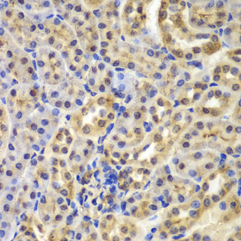 Immunohistochemistry of paraffin-embedded Mouse kidney using IKB alpha Polyclonal Antibody at dilution of  1:100 (40x lens).