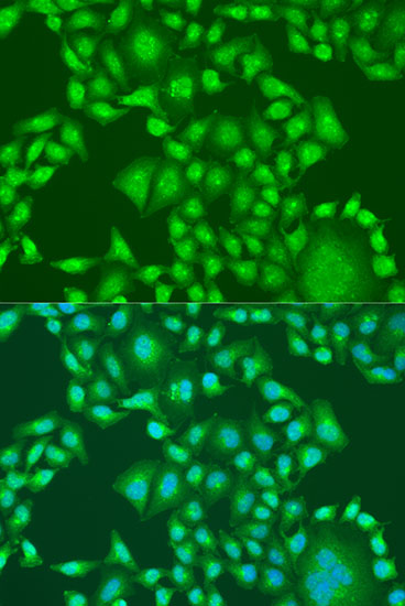 Immunofluorescence analysis of U2OS cells using PTEN Polyclonal Antibody at dilution of  1:100. Blue: DAPI for nuclear staining.