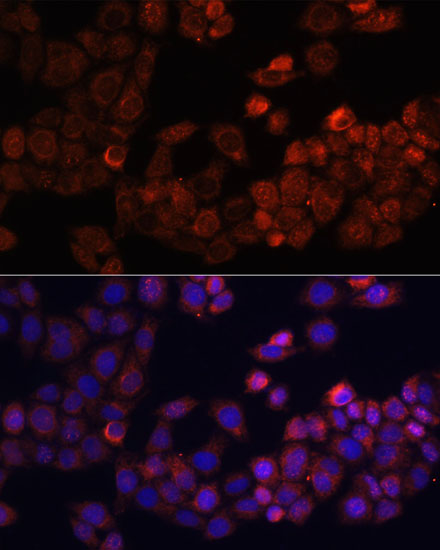 Immunofluorescence analysis of HeLa cells using FAK Polyclonal Antibody at dilution of  1:100. Blue: DAPI for nuclear staining.