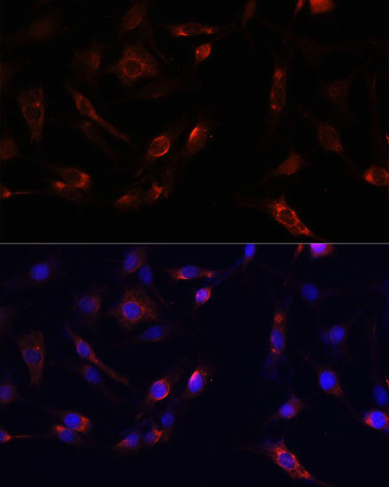 Immunofluorescence analysis of PC12 cells using FAK Polyclonal Antibody at dilution of  1:100. Blue: DAPI for nuclear staining.