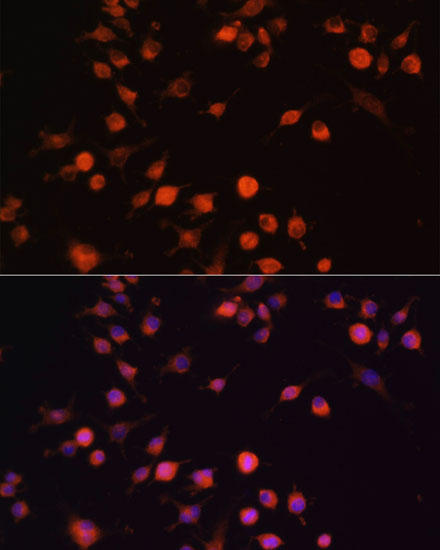 Immunofluorescence analysis of RAW264.7 cells using FAK Polyclonal Antibody at dilution of  1:100. Blue: DAPI for nuclear staining.