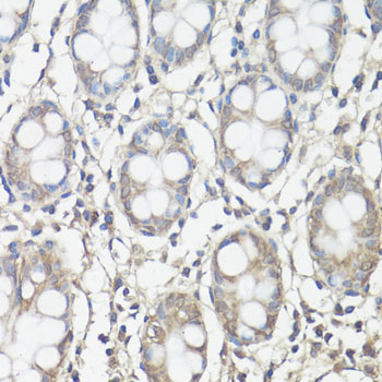 Immunohistochemistry of paraffin-embedded Human colon using FAK Polyclonal Antibody at dilution of  1:100 (40x lens).