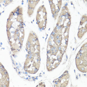 Immunohistochemistry of paraffin-embedded Human stomach using FAK Polyclonal Antibody at dilution of  1:100 (40x lens).