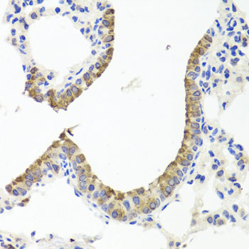 Immunohistochemistry of paraffin-embedded Mouse lung using TTR Polyclonal Antibody at dilution of  1:100 (40x lens).