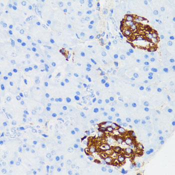 Immunohistochemistry of paraffin-embedded Mouse islets of langerhans using TLR2 Polyclonal Antibody at dilution of  1:150 (40x lens).