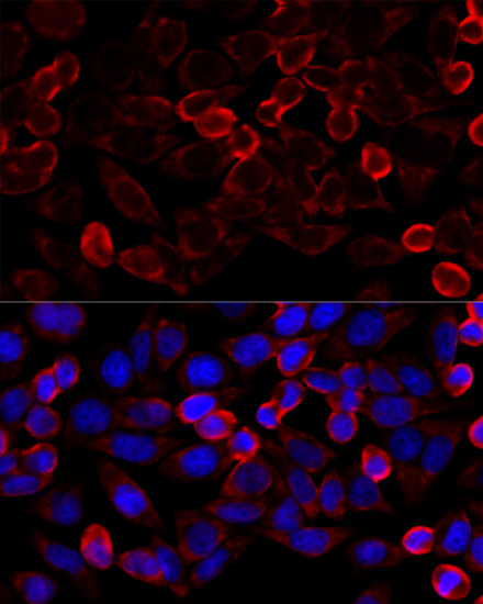 Immunofluorescence analysis of HeLa cells using HDAC6 Polyclonal Antibody at dilution of  1:100 (40x lens). Blue: DAPI for nuclear staining.