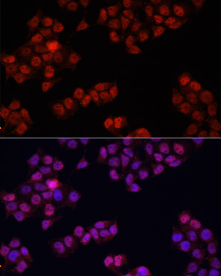 Immunofluorescence analysis of HeLa cells using YAP1 Polyclonal Antibody at dilution of  1:100. Blue: DAPI for nuclear staining.