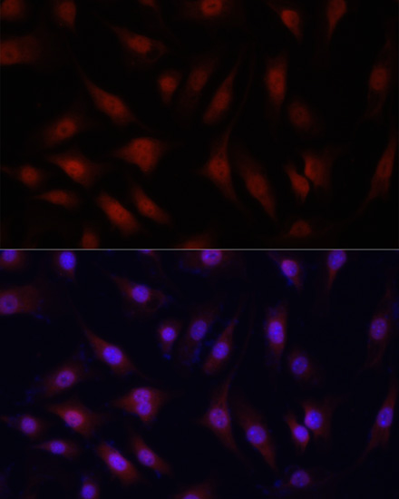 Immunofluorescence analysis of NIH/3T3 cells using YAP1 Polyclonal Antibody at dilution of  1:100. Blue: DAPI for nuclear staining.