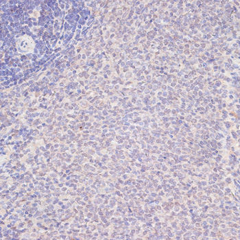 Immunohistochemistry of paraffin-embedded Rat spleen using YAP1 Polyclonal Antibody at dilution of  1:100 (40x lens).