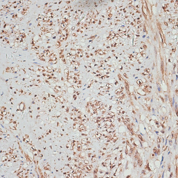 Immunohistochemistry of paraffin-embedded Human uterus using YAP1 Polyclonal Antibody at dilution of  1:100 (40x lens).