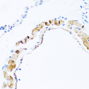 Immunohistochemistry of paraffin-embedded Rat lung using PHPT1 Polyclonal Antibody at dilution of  1:100 (40x lens).