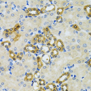 Immunohistochemistry of paraffin-embedded Mouse kidney using PHPT1 Polyclonal Antibody at dilution of  1:100 (40x lens).