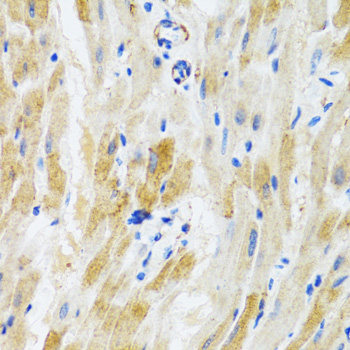 Immunohistochemistry of paraffin-embedded Mouse heart using PHPT1 Polyclonal Antibody at dilution of  1:100 (40x lens).