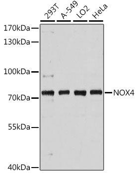 Western blot analysis of extracts of various cell lines using NOX4 Polyclonal Antibody at dilution of 1:3000.