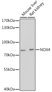 Western blot analysis of extracts of various cell lines using NOX4 Polyclonal Antibody at dilution of 1:3000.